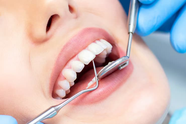 Dental Instruments